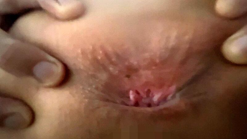 街角で声をかけてアナル観察させてもらう エッチで金欠な女の子 ゆりなちゃん サンプル画像 20
