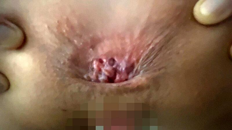 街角で声をかけてアナル観察させてもらう エッチで金欠な女の子 ゆりなちゃん サンプル画像 21