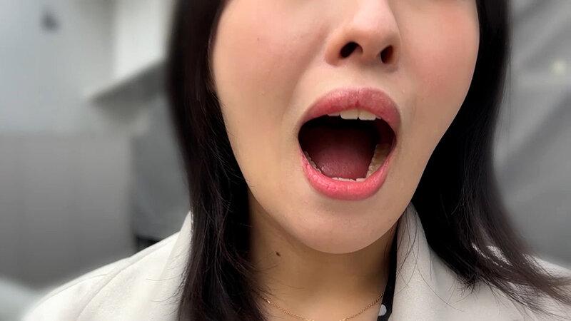 街角で声をかけて口内観察させてもらう スレンダーOL あいちゃん サンプル画像 4
