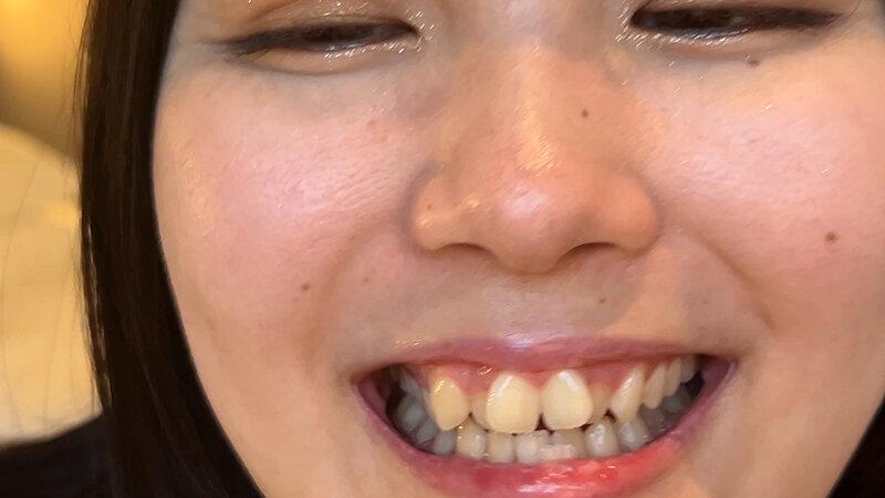 街角で声をかけて口内観察させてもらう カフェ店員 ひなちゃん サンプル画像 15