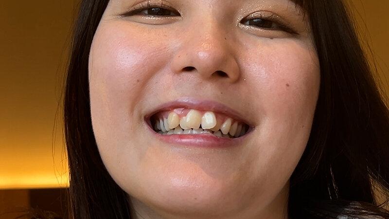 街角で声をかけて口内観察させてもらう カフェ店員 ひなちゃん サンプル画像 20