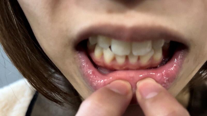 街角で声をかけて口内観察させてもらう オーガニックスーパー勤務 はつみちゃん サンプル画像 13