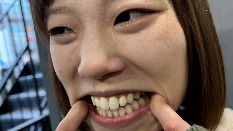 街角で声をかけて口内観察させてもらう オーガニックスーパー勤務 はつみちゃん サンプル画像 14
