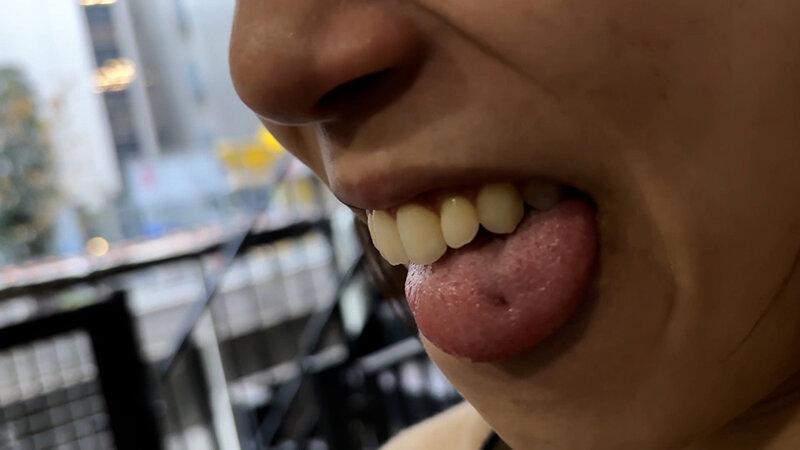 街角で声をかけて口内観察させてもらう オーガニックスーパー勤務 はつみちゃん サンプル画像 18