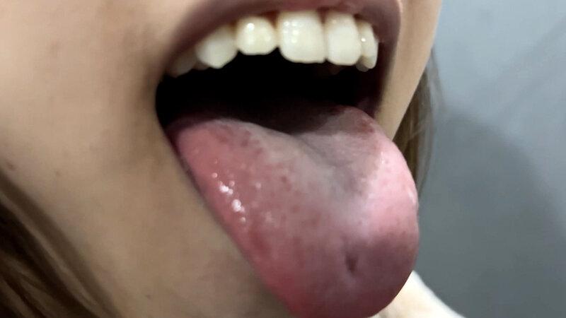 街角で声をかけて口内観察させてもらう オーガニックスーパー勤務 はつみちゃん サンプル画像 21
