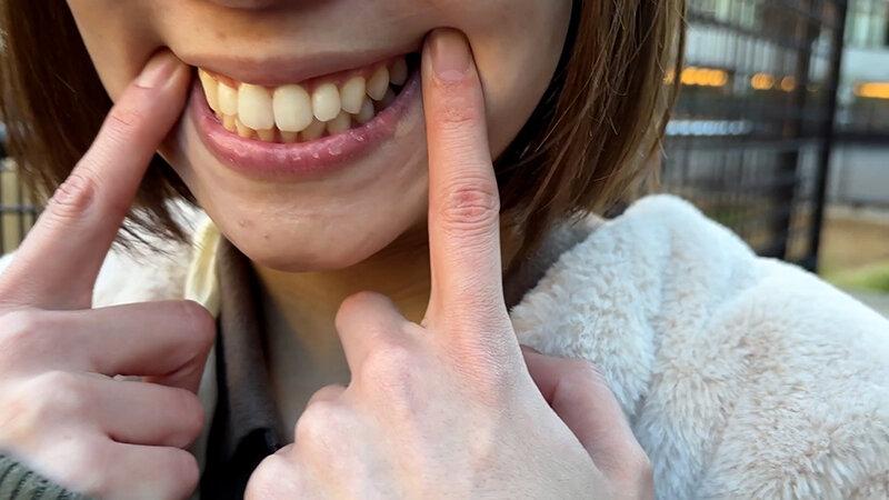 街角で声をかけて口内観察させてもらう オーガニックスーパー勤務 はつみちゃん サンプル画像 4