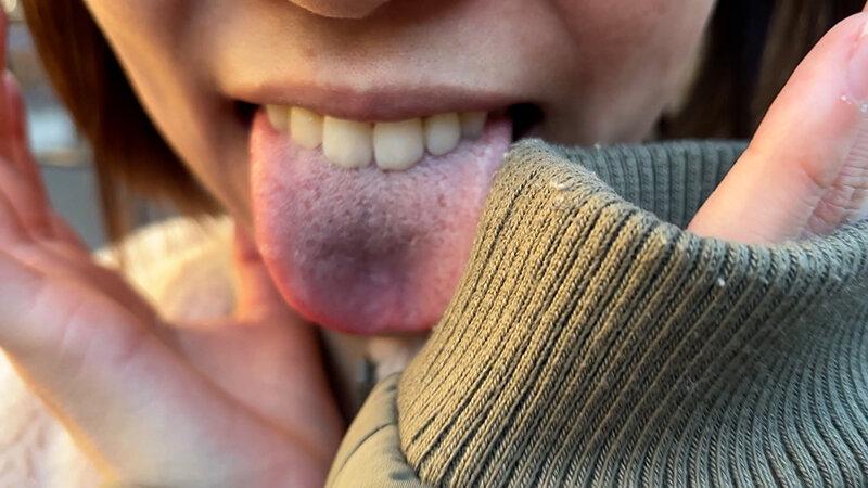 街角で声をかけて口内観察させてもらう オーガニックスーパー勤務 はつみちゃん サンプル画像 6
