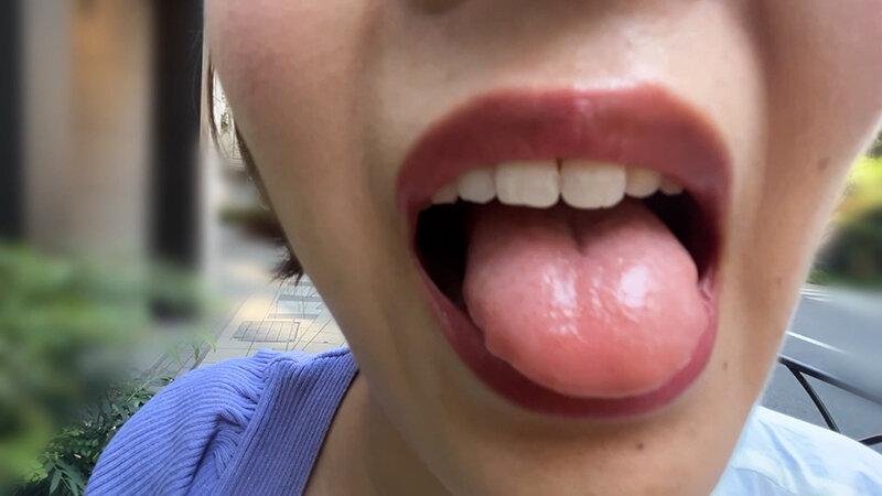 街角で声をかけて口内観察させてもらう アパレル店員 さつきちゃん サンプル画像 7